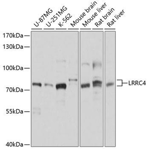 Anti-LRRC4 Antibody (CAB10321)