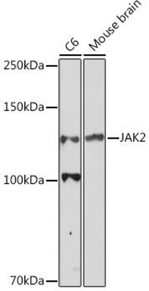 Anti-JAK2 Antibody (CAB11497)