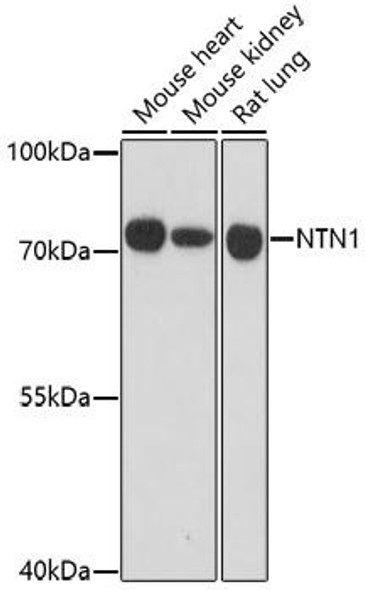 Anti-NTN1 Antibody (CAB16236)