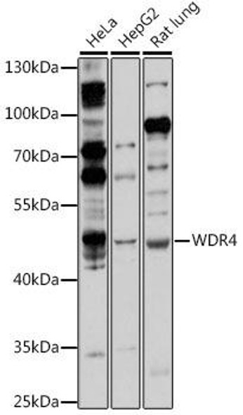 Anti-WDR4 Antibody (CAB16487)