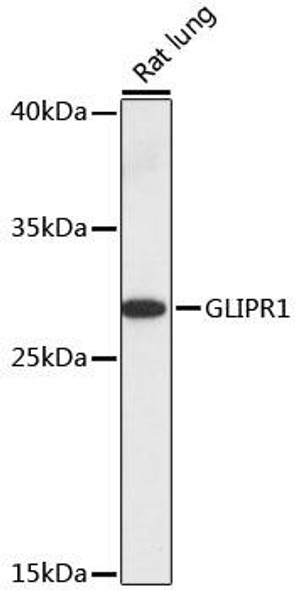 Anti-GLIPR1 Antibody (CAB16490)