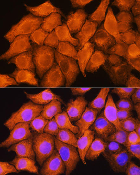 Anti-ASS1 Antibody (CAB2012)