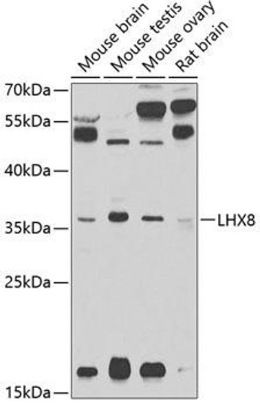 Anti-LHX8 Antibody (CAB2046)