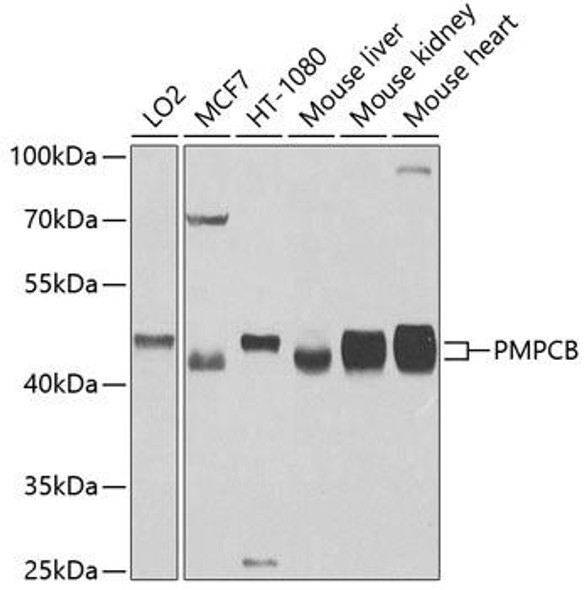 Anti-PMPCB Antibody (CAB4312)