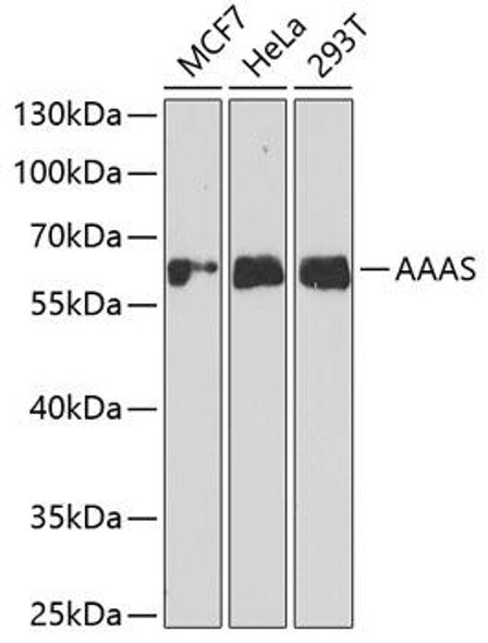 Anti-AAAS Antibody (CAB6427)