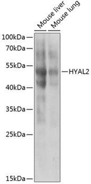 Anti-HYAL2 Antibody (CAB6624)