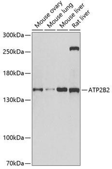 Anti-ATP2B2 Antibody (CAB6875)