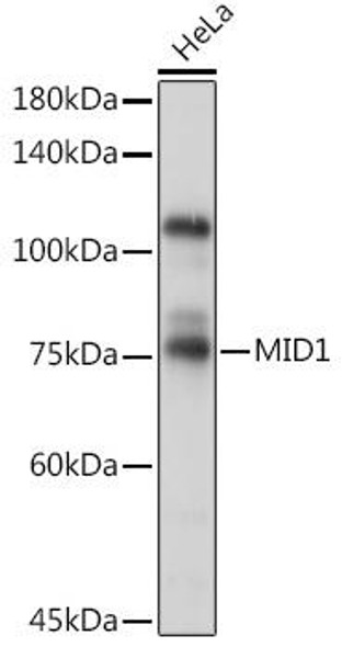 Anti-MID1 Antibody (CAB7291)