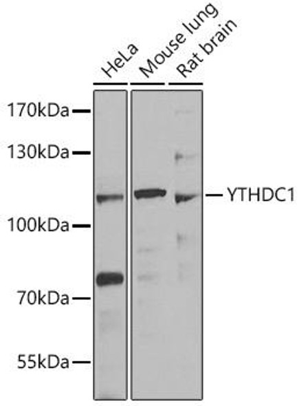 Anti-YTHDC1 Antibody (CAB7318)