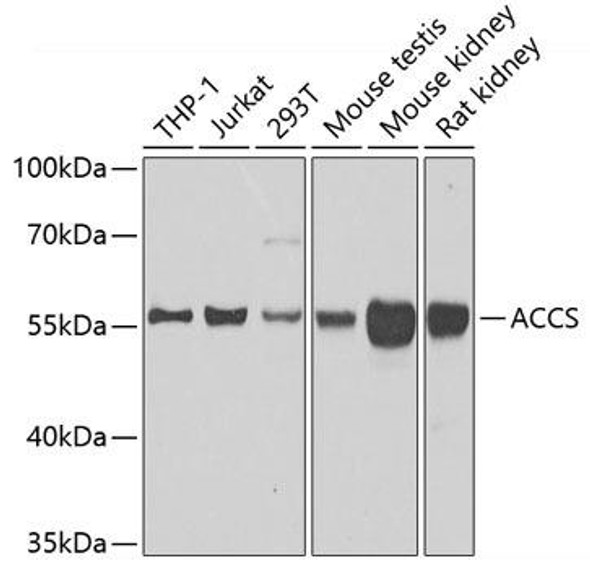 Anti-ACCS Antibody (CAB7395)