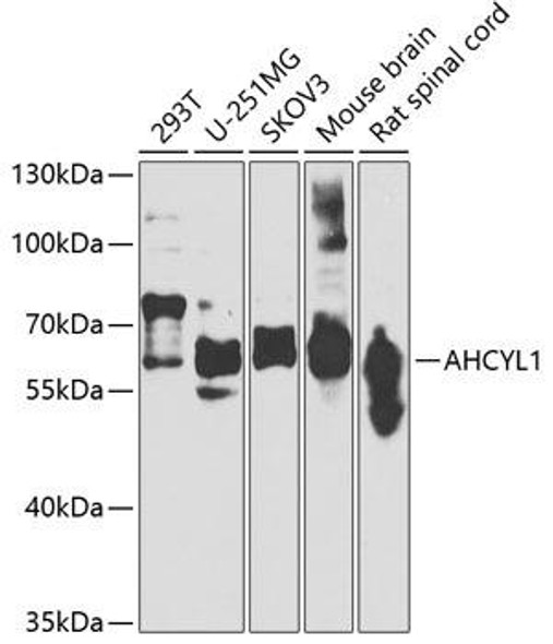 Anti-AHCYL1 Antibody (CAB7773)