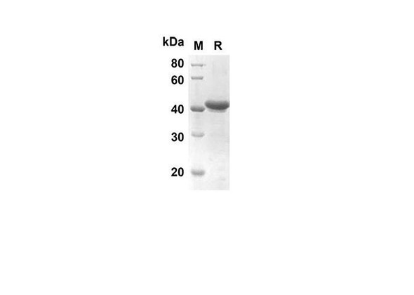 Recombinant Human IVL Protein(Trx Tag) (RPES8006)