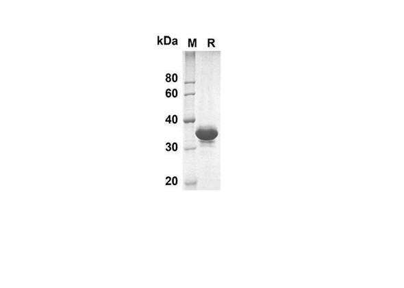 Recombinant Human DAND5 Protein(Trx Tag) (RPES8011)