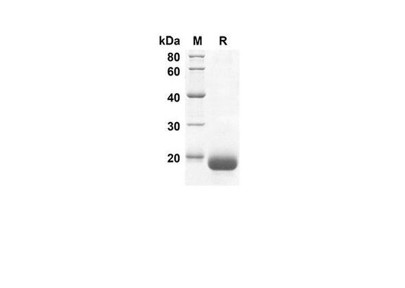 Recombinant Human DEFB1 Protein(Sumo Tag) (RPES8018)