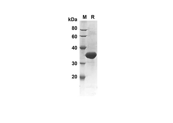 Recombinant Human CASP7 Protein(Sumo Tag) (RPES8022)
