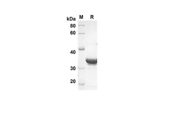 Recombinant Human G-CSF Protein(Trx Tag) (RPES8023)