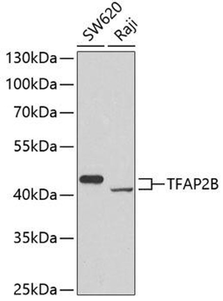 Anti-TFAP2B Antibody (CAB7935)