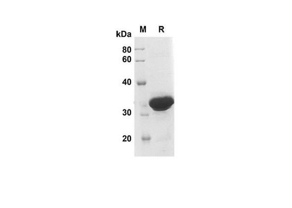 Recombinant Human MPO Protein(Trx Tag) (RPES8075)