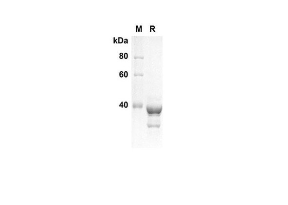 Recombinant Human PRKAA1 Protein(Trx Tag) (RPES8078)