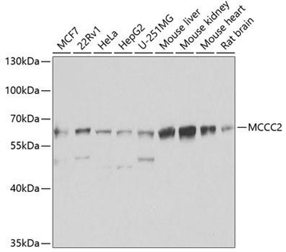 Anti-MCCC2 Antibody (CAB7990)