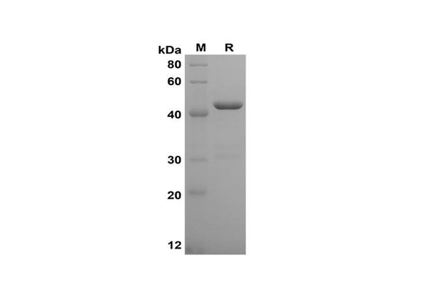 Recombinant Human TNF-Â± Protein(Gst Tag) (RPES8100)
