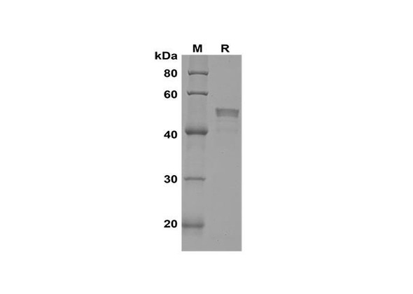 Recombinant Human CANX Protein(Sumo Tag) (RPES8132)