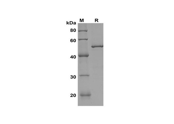 Recombinant Human STAT6 Protein(Trx Tag) (RPES8135)