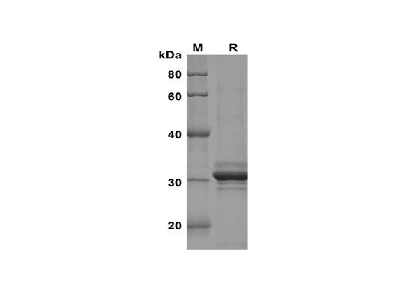 Recombinant Human LC3A/B Protein(Trx Tag) (RPES8137)