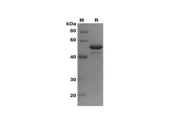 Recombinant Human TH TYH Protein(Trx Tag) (RPES8140)