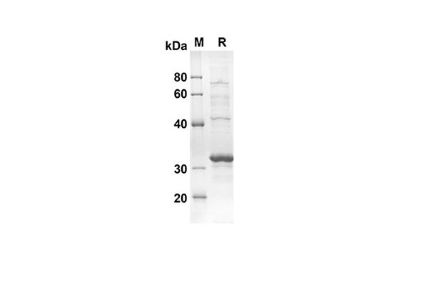 Recombinant Mouse RETN Protein(Trx Tag) (RPES8153)