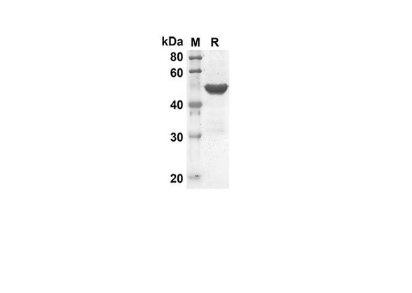 Recombinant Mouse TNFSF10 Protein(Gst Tag) (RPES8160)