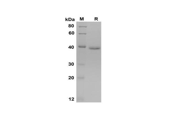 Recombinant Mouse P¢â¦Â¢NP Protein(Trx Tag) (RPES8174)
