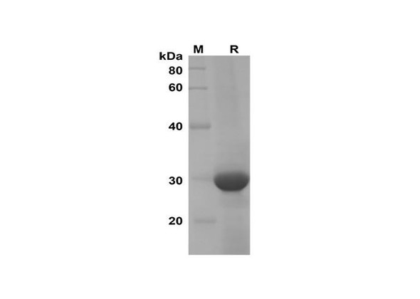 Recombinant Mouse CXCL7 Protein(Trx Tag) (RPES8185)