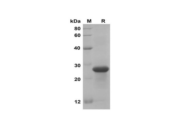 Recombinant Mouse PROK1 Protein(Sumo Tag) (RPES8199)