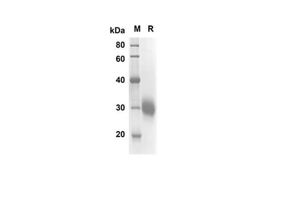 Recombinant Human FCGR2A Protein(His Tag) (RPES8272)