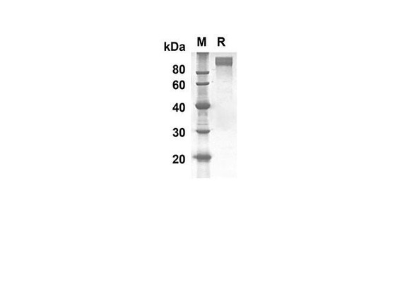 Recombinant Human GPNMB Protein(Fc Tag) (RPES8274)
