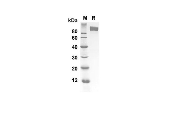 Recombinant Human IL6ST Protein(Fc Tag) (RPES8278)