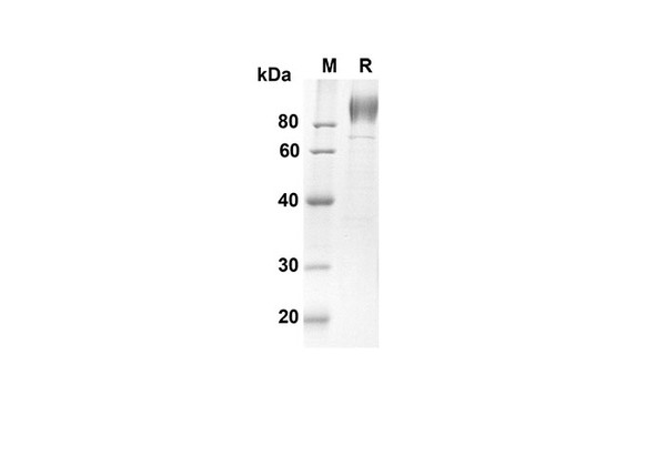 Recombinant Human IL6ST Protein (His Tag) (RPES8290)