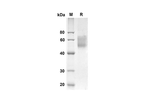 Recombinant Human Sell Protein (His Tag) (RPES8296)