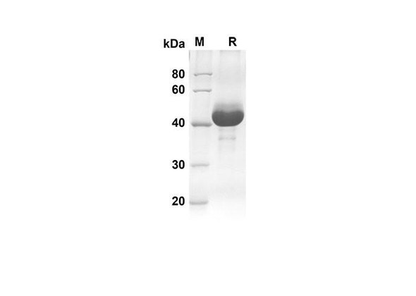 Recombinant human CDNF Protein (Fc Tag) (RPES8312)