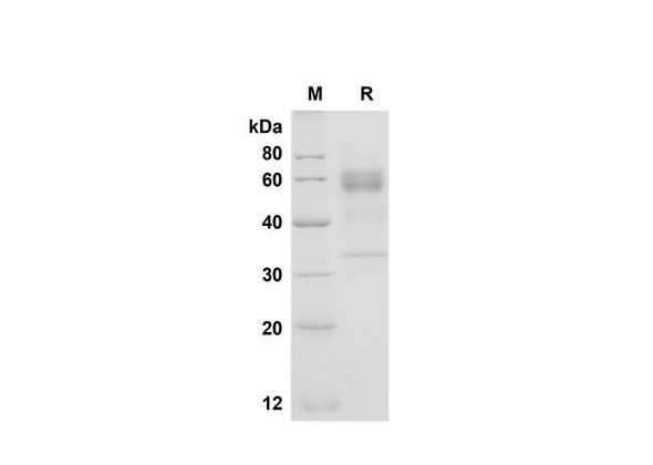 Recombinant Human Folate Binding protein/FBP Protein (Fc Tag) (RPES8324)