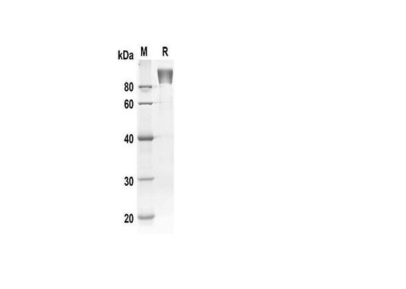 Recombinant Human AXL/UFO Protein (Fc Tag) (RPES8335)