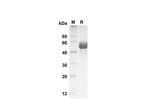 Recombinant Human SCF/c-kit Ligand Protein (Fc Tag) (RPES8347)