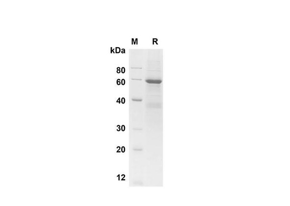 Recombinant Human SP-A1 Protein (Fc Tag) (RPES8363)