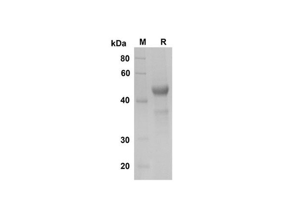 Recombinant Human LIGHT/TNFSF14 Protein (Fc Tag) (RPES8364)
