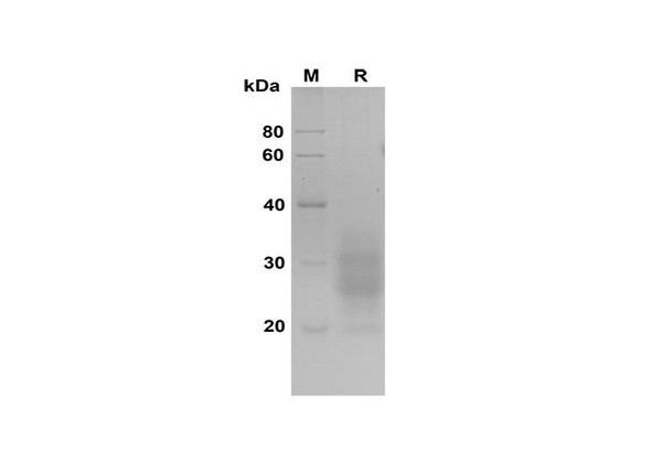 Recombinant human Flt-3 Ligand Protein (His Tag) (RPES8370)