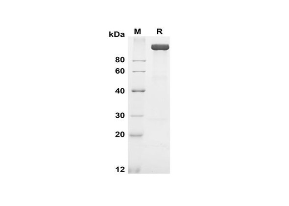 Recombinant Human APN Protein (Fc Tag) (RPES8388)