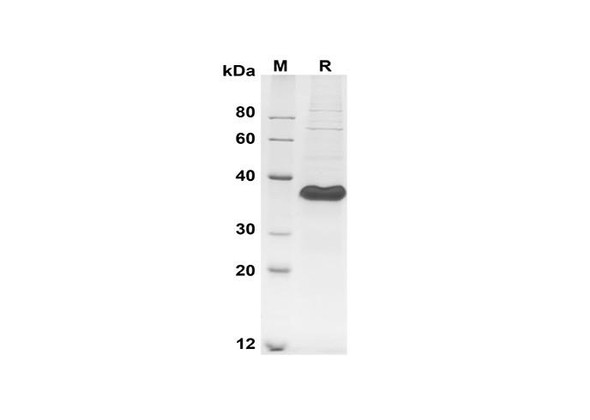 Recombinant Human Follistatin-related Gene Protein/FLRG Protein (His Tag) (RPES8389)