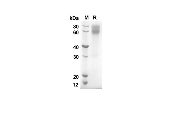 Recombinant Mouse Cd80 Protein (FC Tag) (RPES8396)