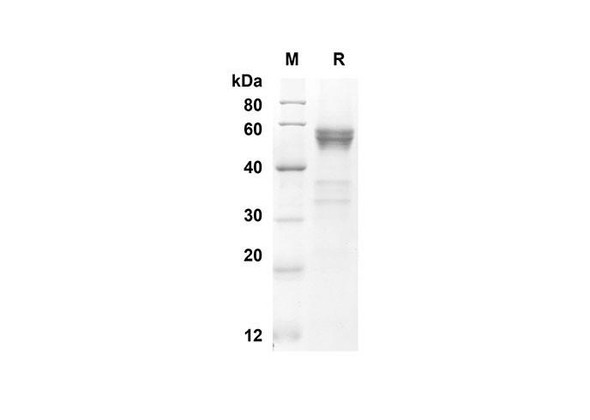 Recombinant Mouse FLT3LG Protein (Fc Tag) (RPES8399)